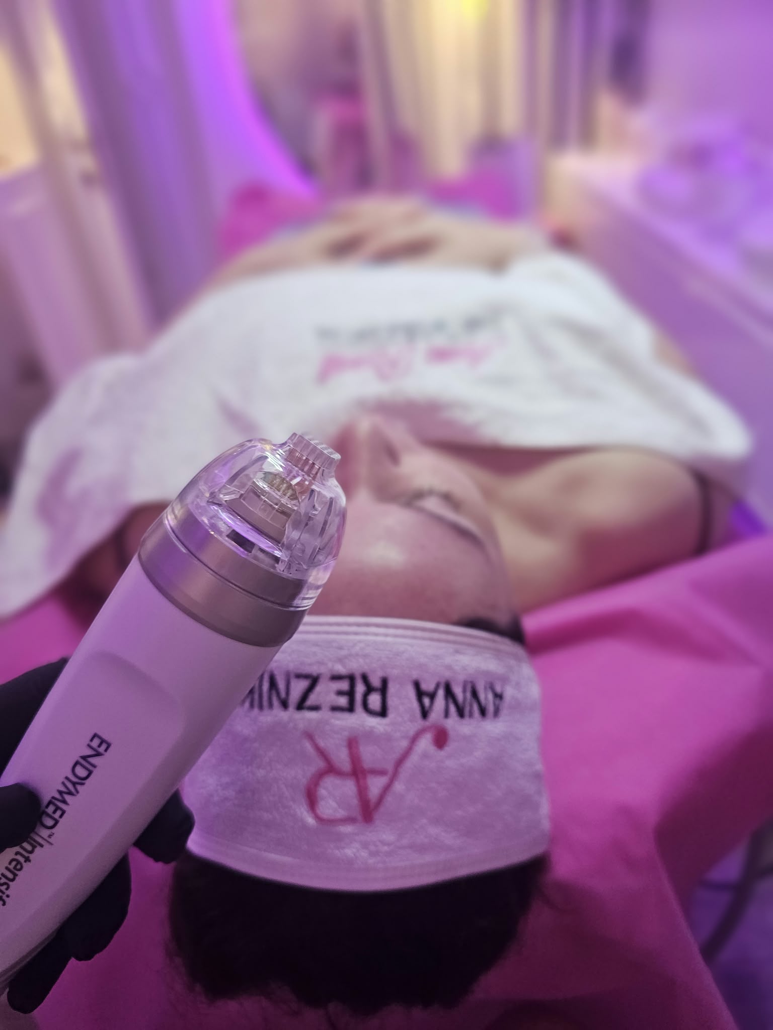 טיפול RF Fractional